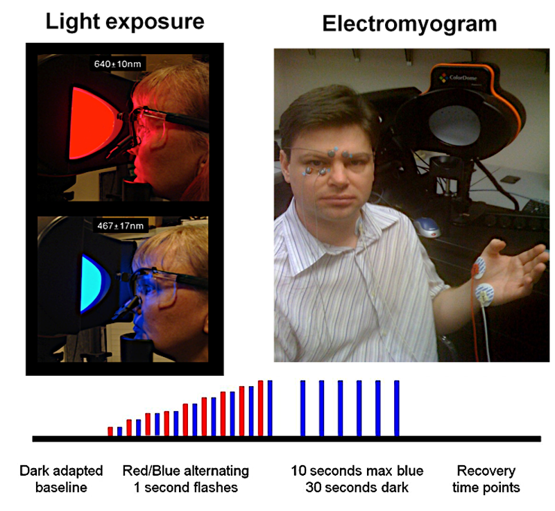 Facial Responses to Light Are Exaggerated in Light Sensitive Patients