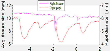 Average fissure size vs. pupil diameter