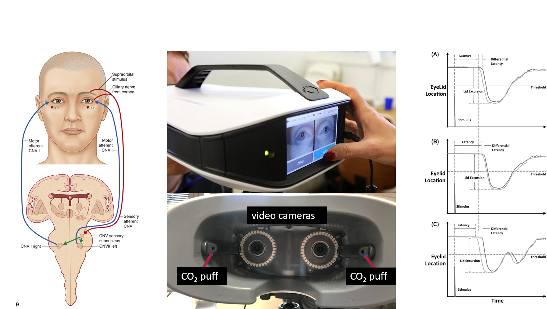 Corneal Blink Reflex – C02