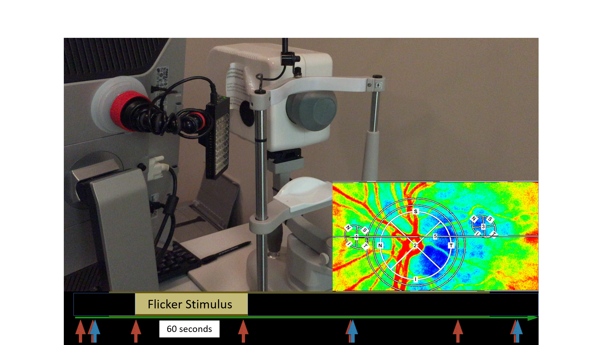 Light Flicker Evoked Increases in Ocular Blood Flow