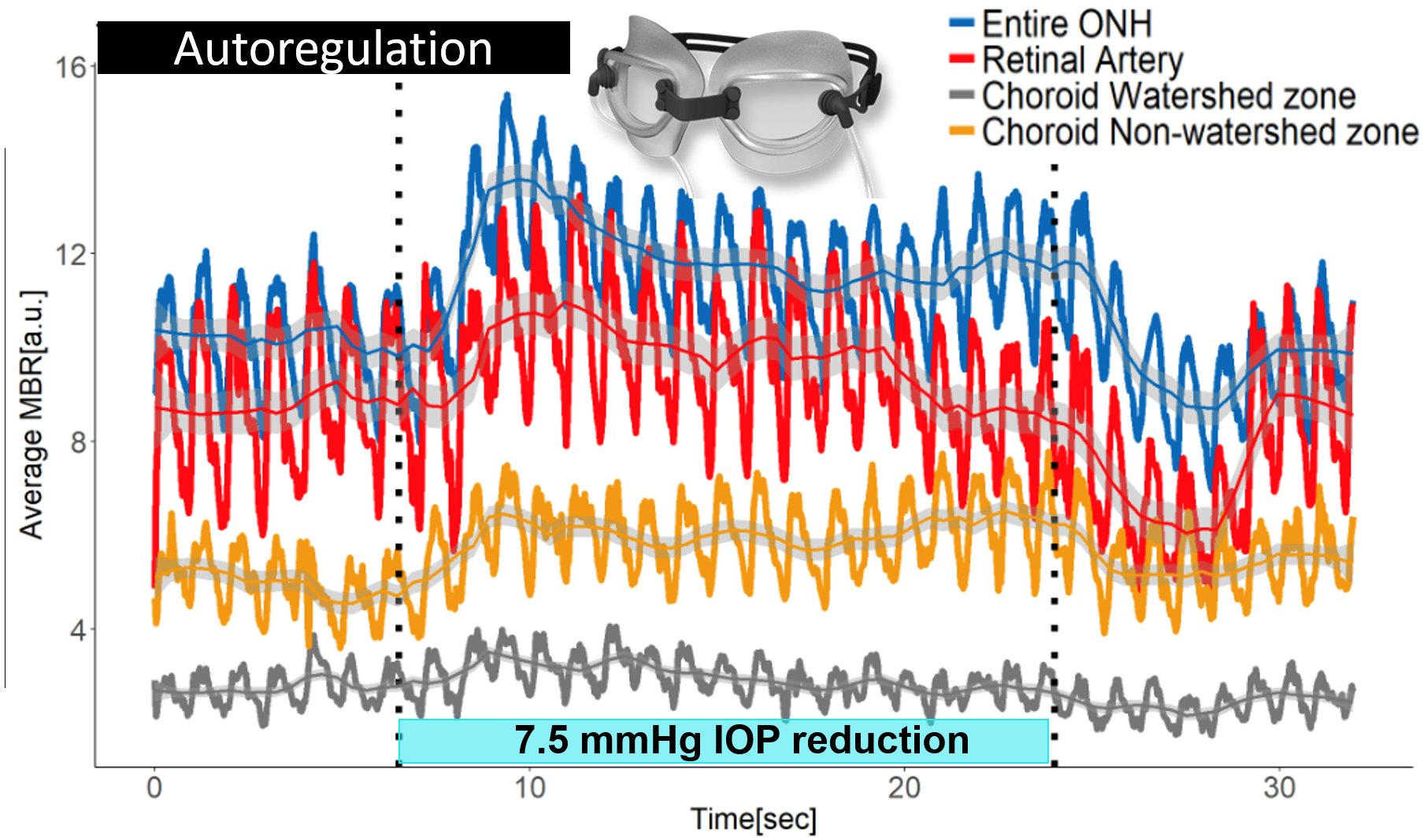 Autoregulation