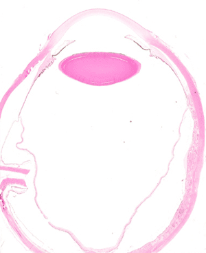 Eye Path 1